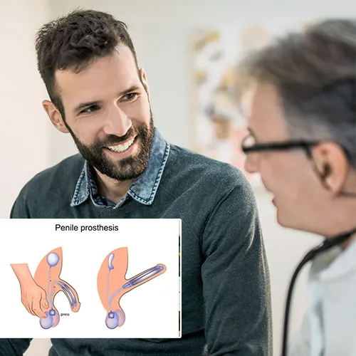 Advanced Urology Surgery Center

: Your Guide to Understanding Penile Implants