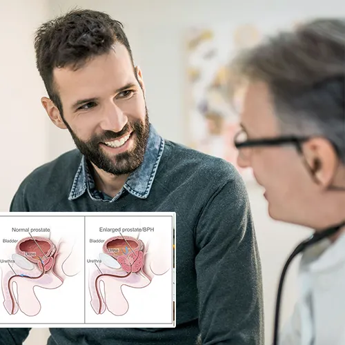 Welcome to  Advanced Urology Surgery Center

: Exploring the Life-Changing Benefits of Penile Implants